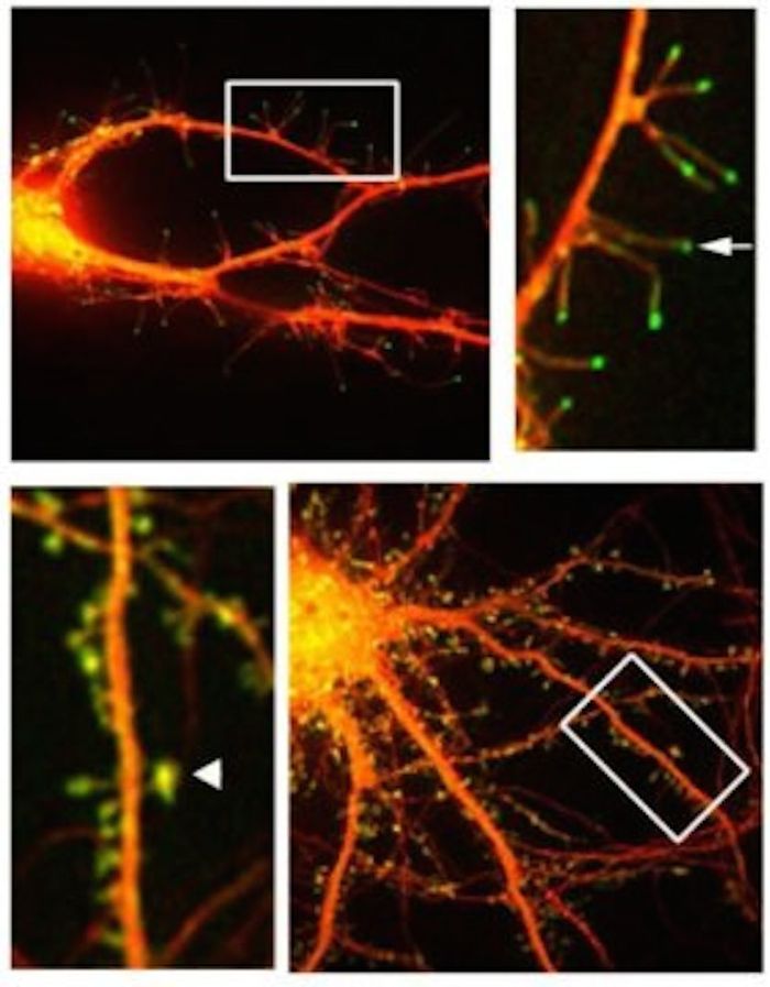 This is a fluorescent microphotograph of neurons that shows filapodia extending out from dendrite. This is a fluorescent microphotograph of neurons that shows filapodia extending out from dendrite.