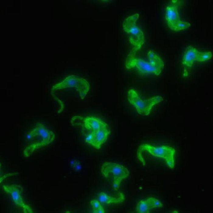 Microscopy image of Trypanosoma brucei, the African sleeping sickness parasite Microscopy image of Trypanosoma brucei, the African sleeping sickness parasite