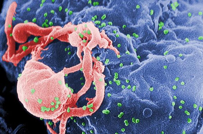Research on viral genome could lead to clinical solution for leukemia and HIV. Research on viral genome could lead to clinical solution for leukemia and HIV.