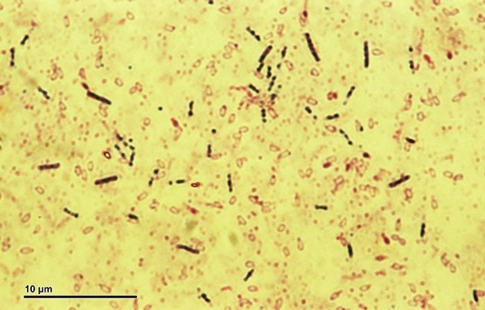 Bacillus subtilis bacteria Bacillus subtilis bacteria