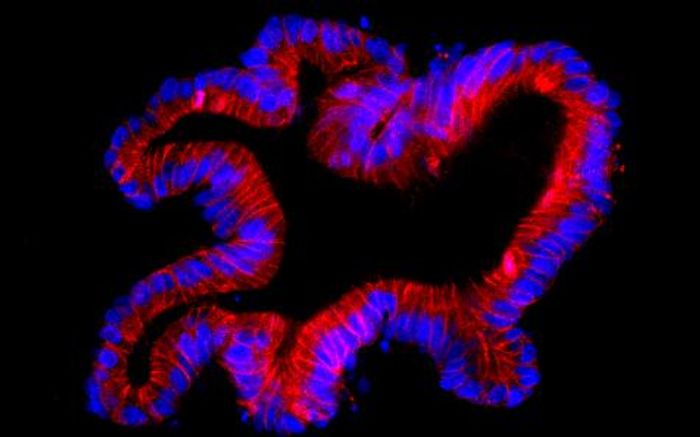 A Toxin Produced By C Difficile Can Damage Intestinal Stem Cells