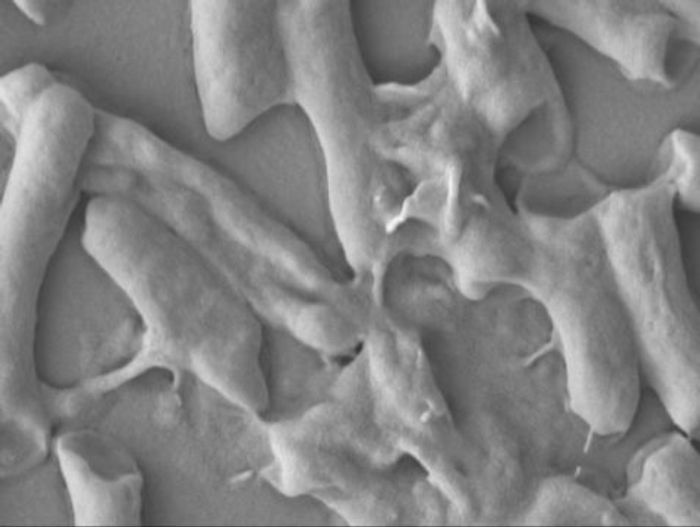 New Material Developed That Quickly Kills E.coli Microbiology