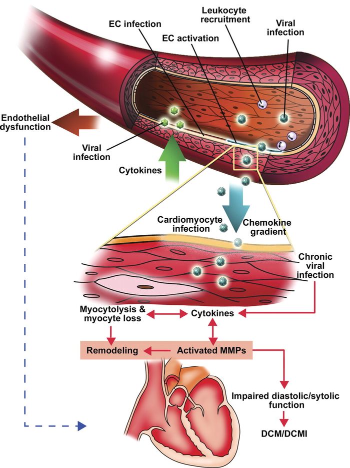 Viral Infection of the Heart | Health And Medicine