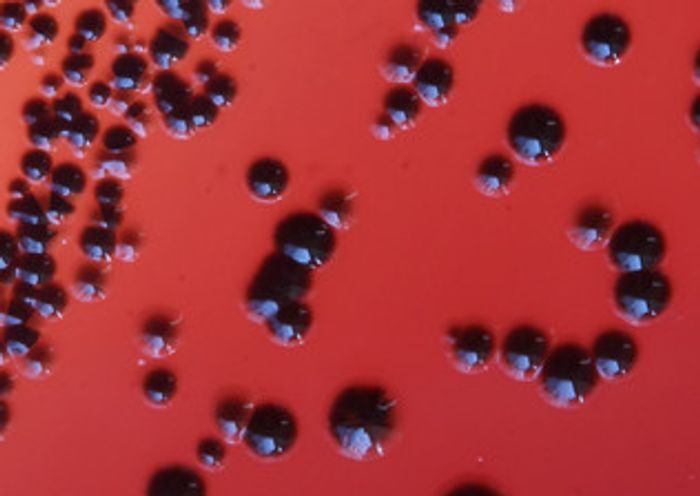 P. gingivalis colonies have a black pigment.