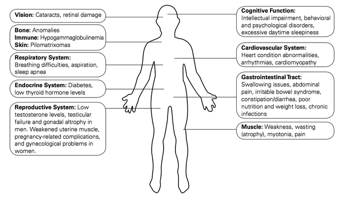 Symptoms of DM - via www.geneticdisorders.info
