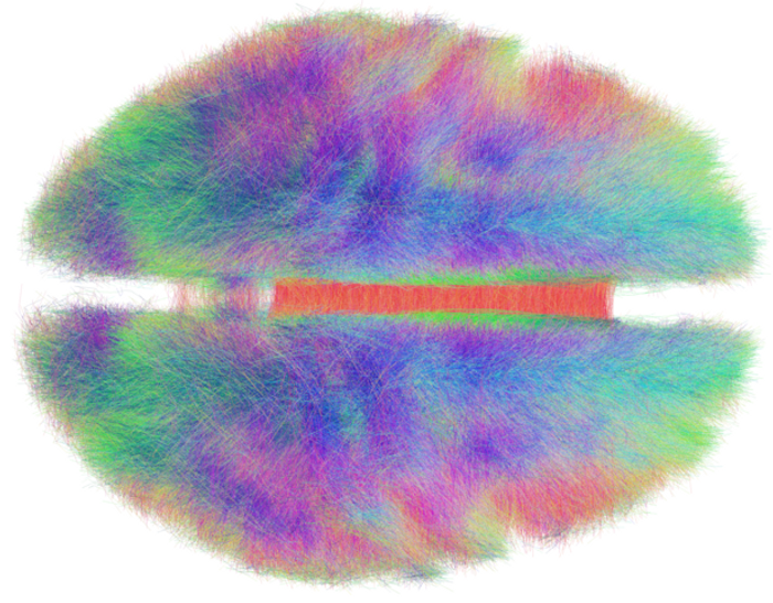 The human connectome