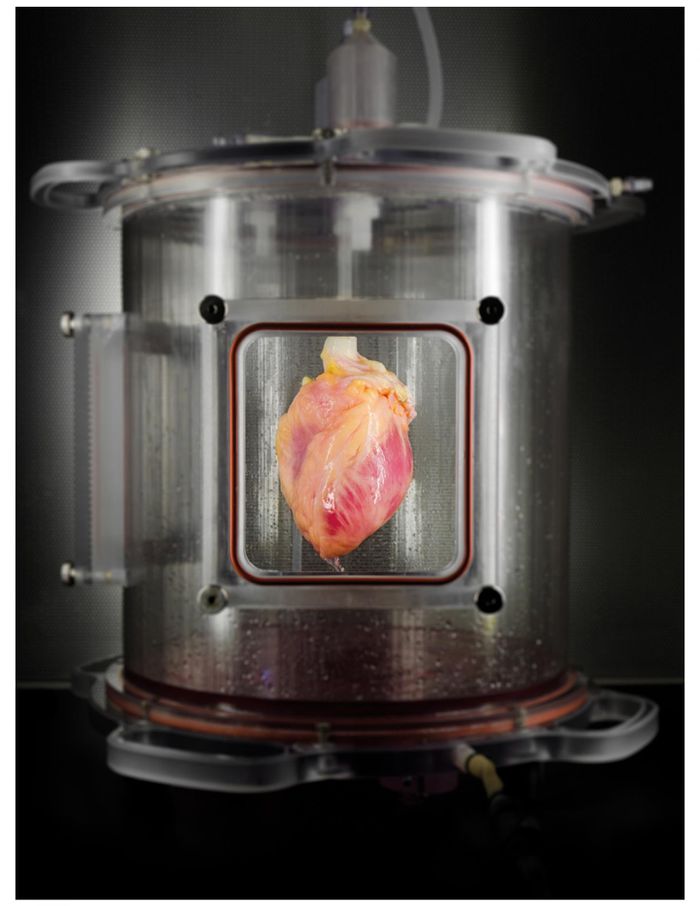A partially recellularized human whole-heart cardiac scaffold, reseeded with human cardiomyocytes derived from induced pluripotent stem cells, being cultured in a bioreactor that delivers a nutrient solution and replicates some of the environmental conditions around a living heart.