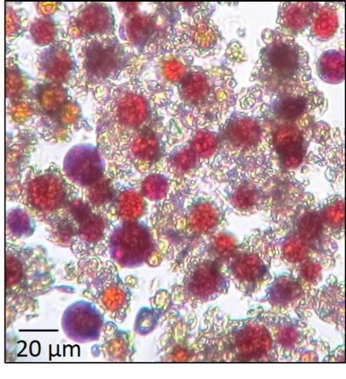 A colony of red snow algae under a microscope. Image by Stefanie Lutz/GFZ